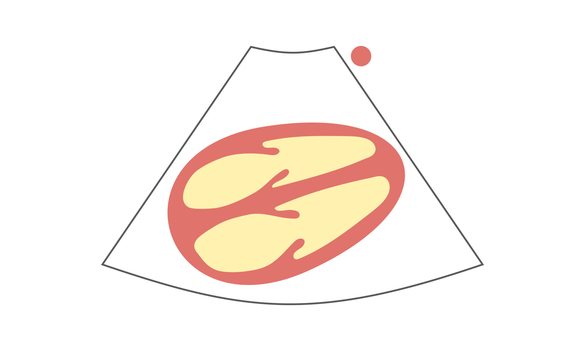 Diagram of subxiphoid view of echocardiography healthcare concept