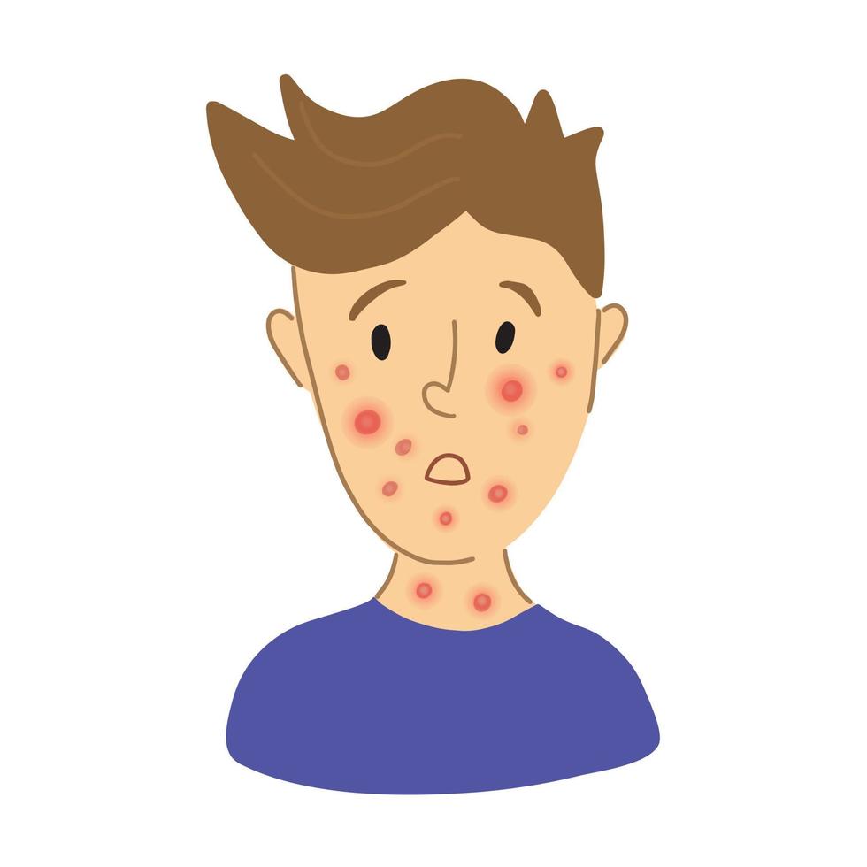 Male suffering from new virus Monkeypox. kid face sick with chickenpox pox virus infection. flat character portrait. Red rash on face - symptoms of smallpox chickempox, monkeypox vector