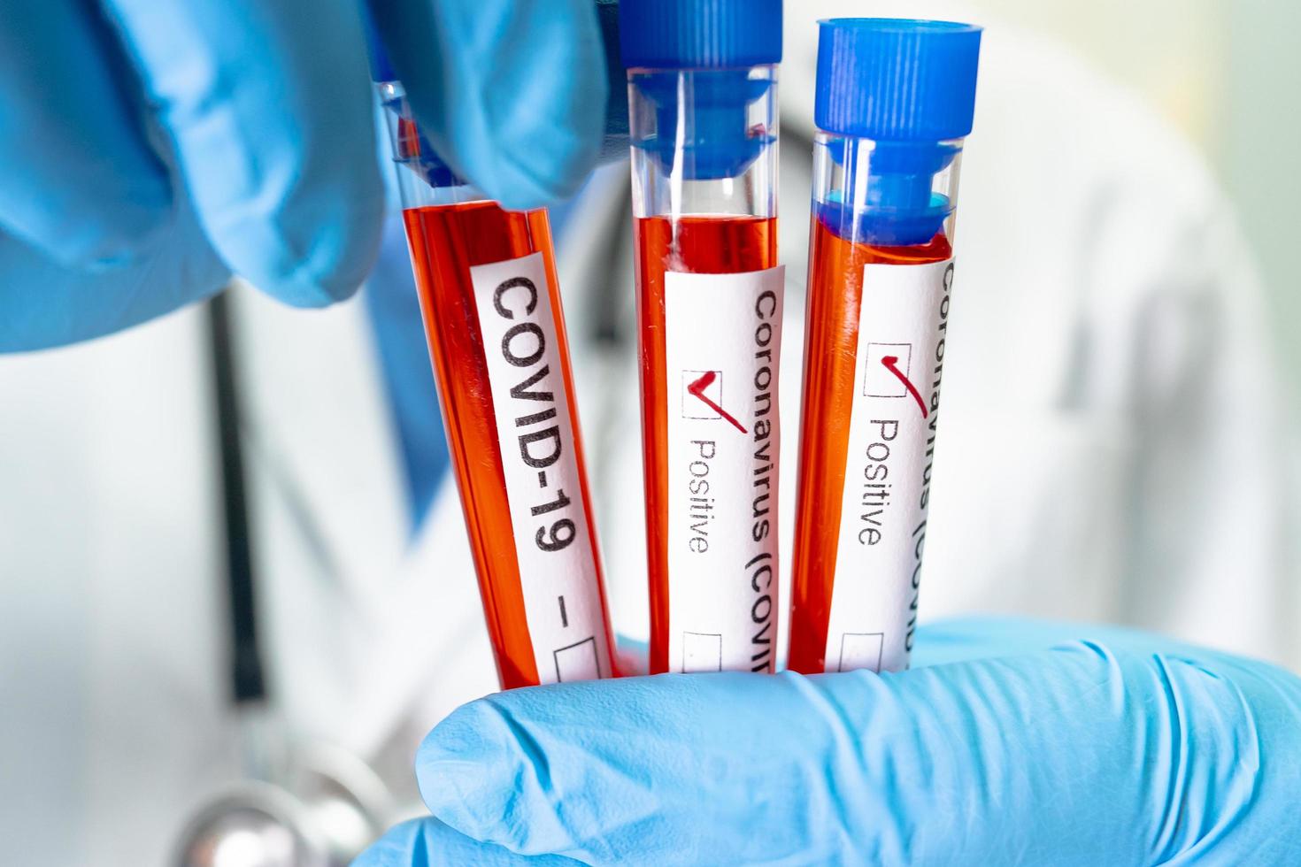 Positive blood infection sample in test tube for covid-19 coronavirus in lab. Scientist holding to check and analyze for patient in hospital. photo