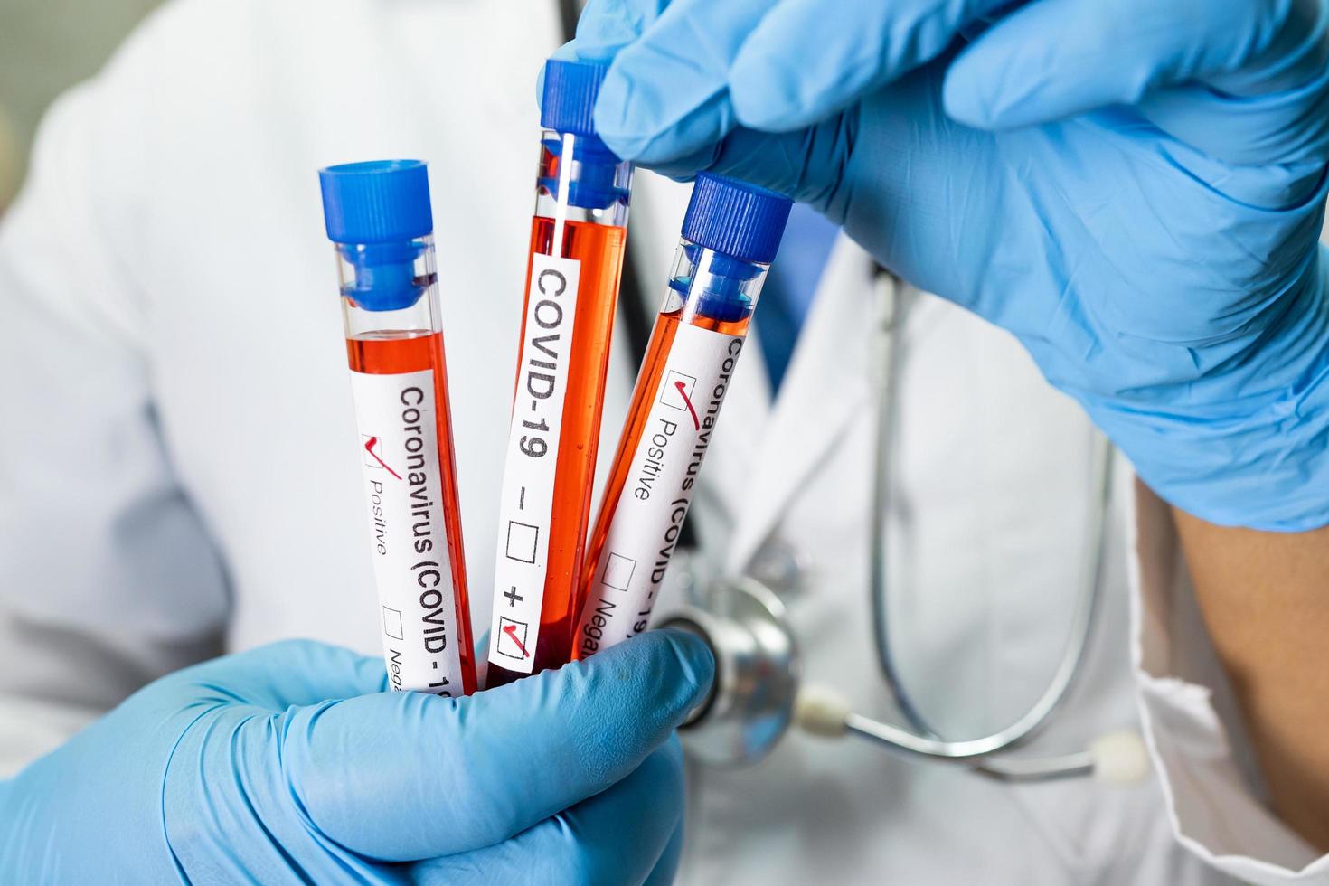 Positive blood infection sample in test tube for covid-19 coronavirus in lab. Scientist holding to check and analyze for patient in hospital. photo