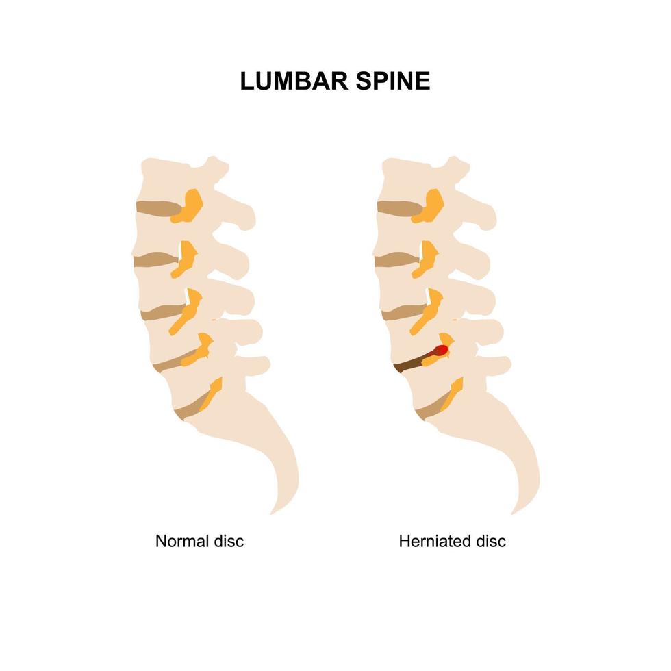 ilustración vectorial de la columna lumbar humana sobre fondo blanco vector