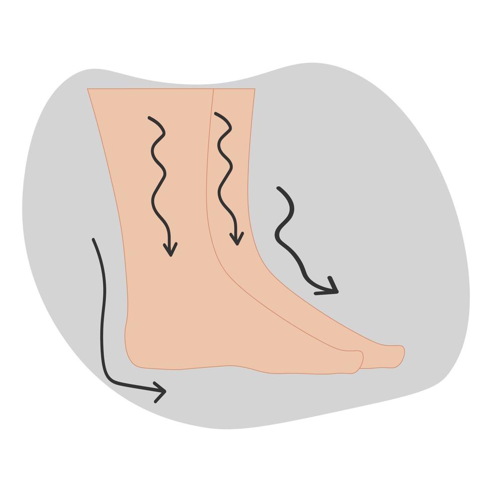 Human feet and leg swelling vector