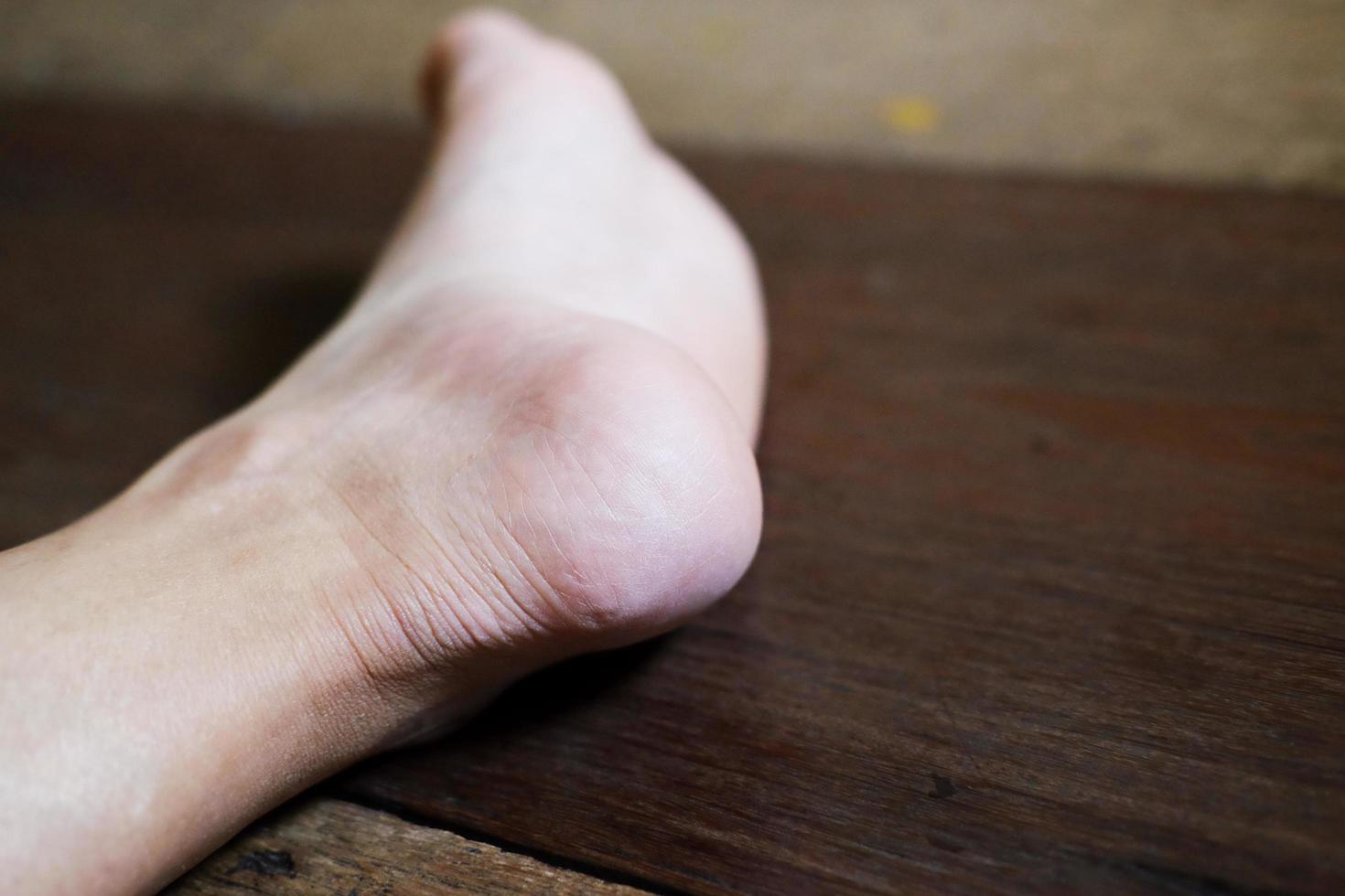 Closed up female feet with french nails on wood floor, Healthy care and medical concept photo