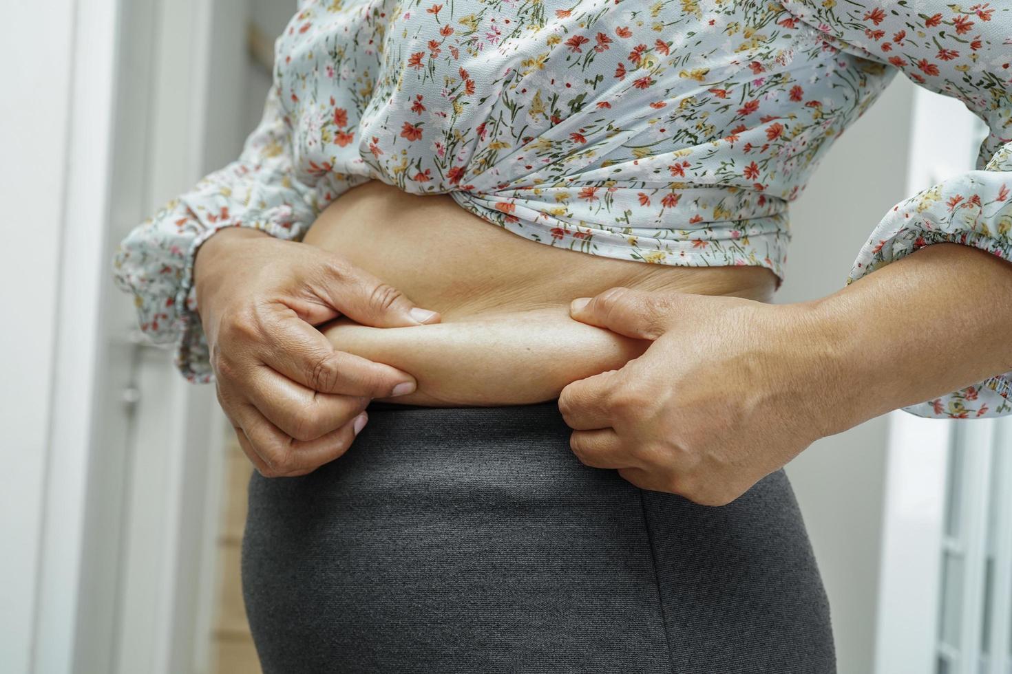 mujer asiática con sobrepeso usa la mano para apretar el vientre gordo de gran tamaño con sobrepeso y obesidad. foto