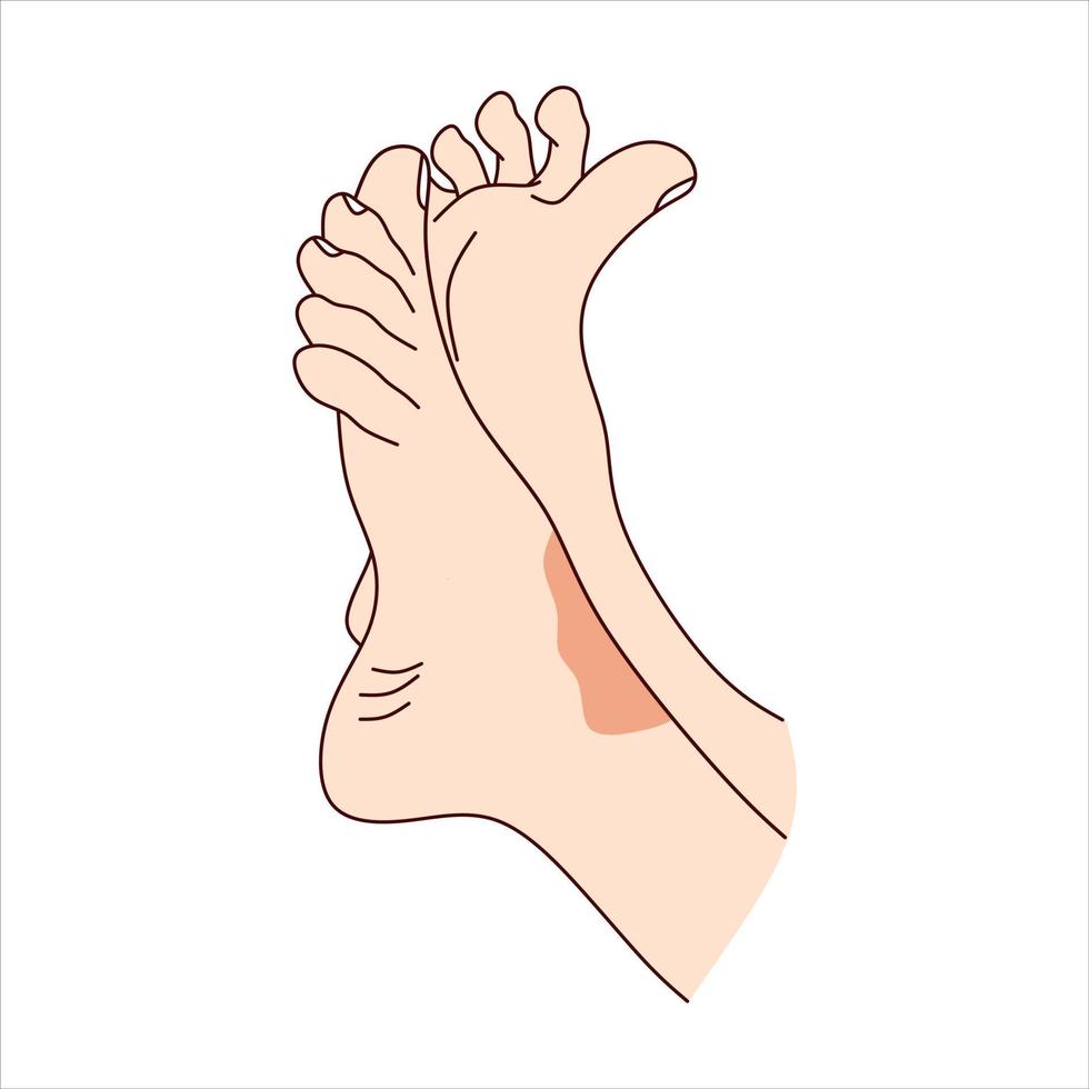 pies con erupción cutánea psoriasis vector