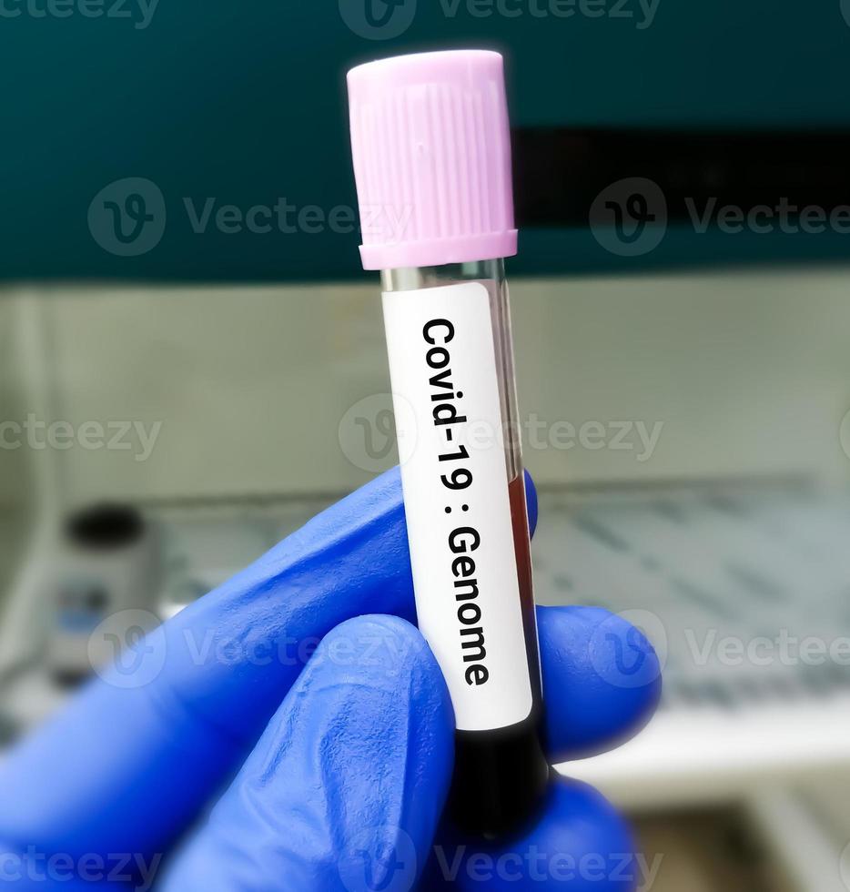 Covid 19 genome test, PCR covid-19 genomic test. photo