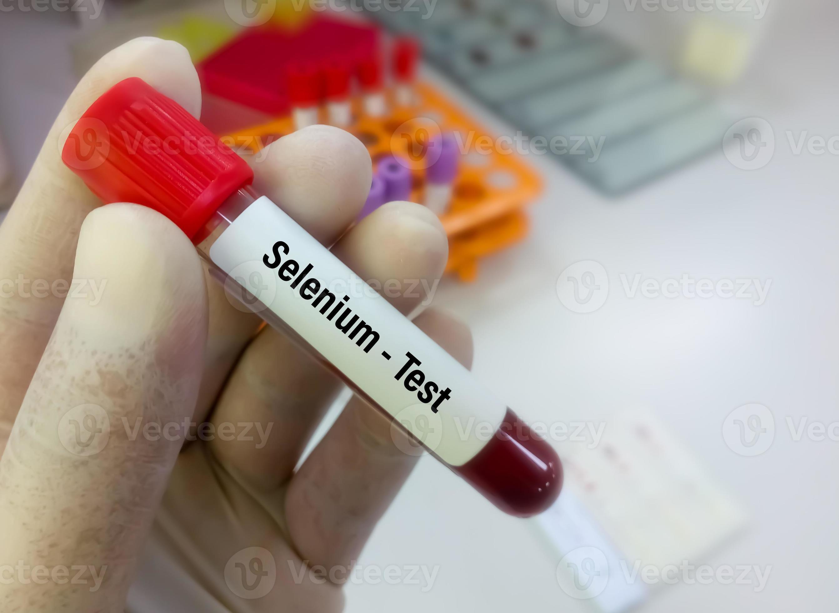 Blood sample for Selenium test. 8012809 Stock Photo at Vecteezy