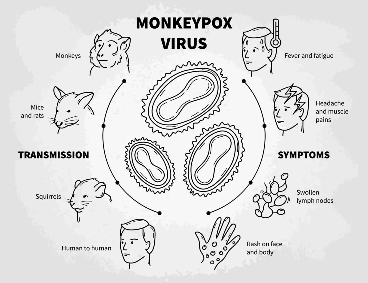 Monkeypox infectious disease vector infographic, medical scheme with poxviruses, symptoms and transmission. Fever and rash from monkeys, rats and squirrels. linear icons in doodle sketch style