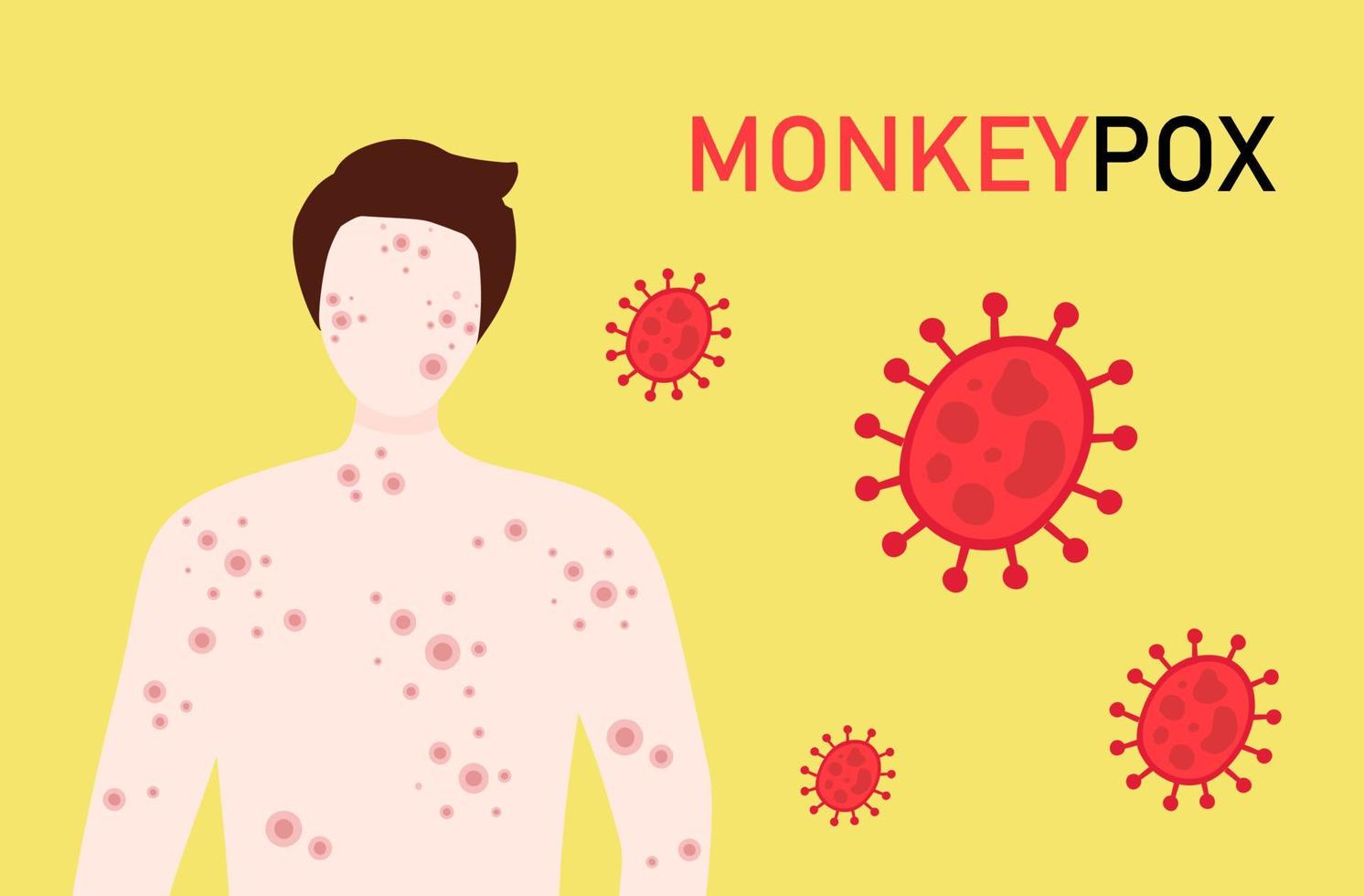 concepto de virus de la viruela del mono, mujer que sufre de erupción en todo el cuerpo. nueva ilustración de vector de propagación de pandemia de brote de virus orthopox