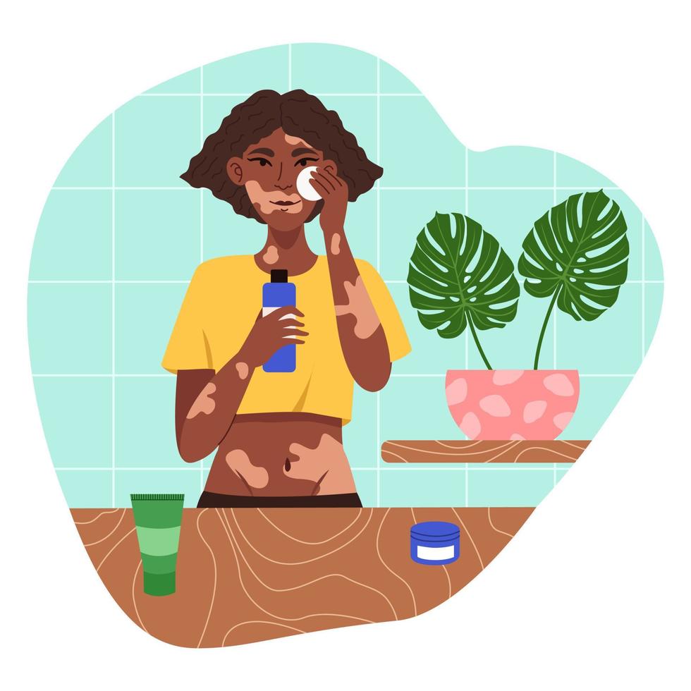 Girl with skin problems Vitiligo applies natural cosmetics for daily skin care. Morning everyday routine. Modern vector flat illustration isolated on a white background.
