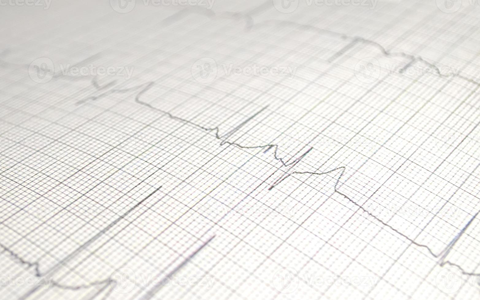 gráfico de cardiograma con primer plano de la mesa médica, para el registro cardíaco del cirujano, enfoque selectivo foto
