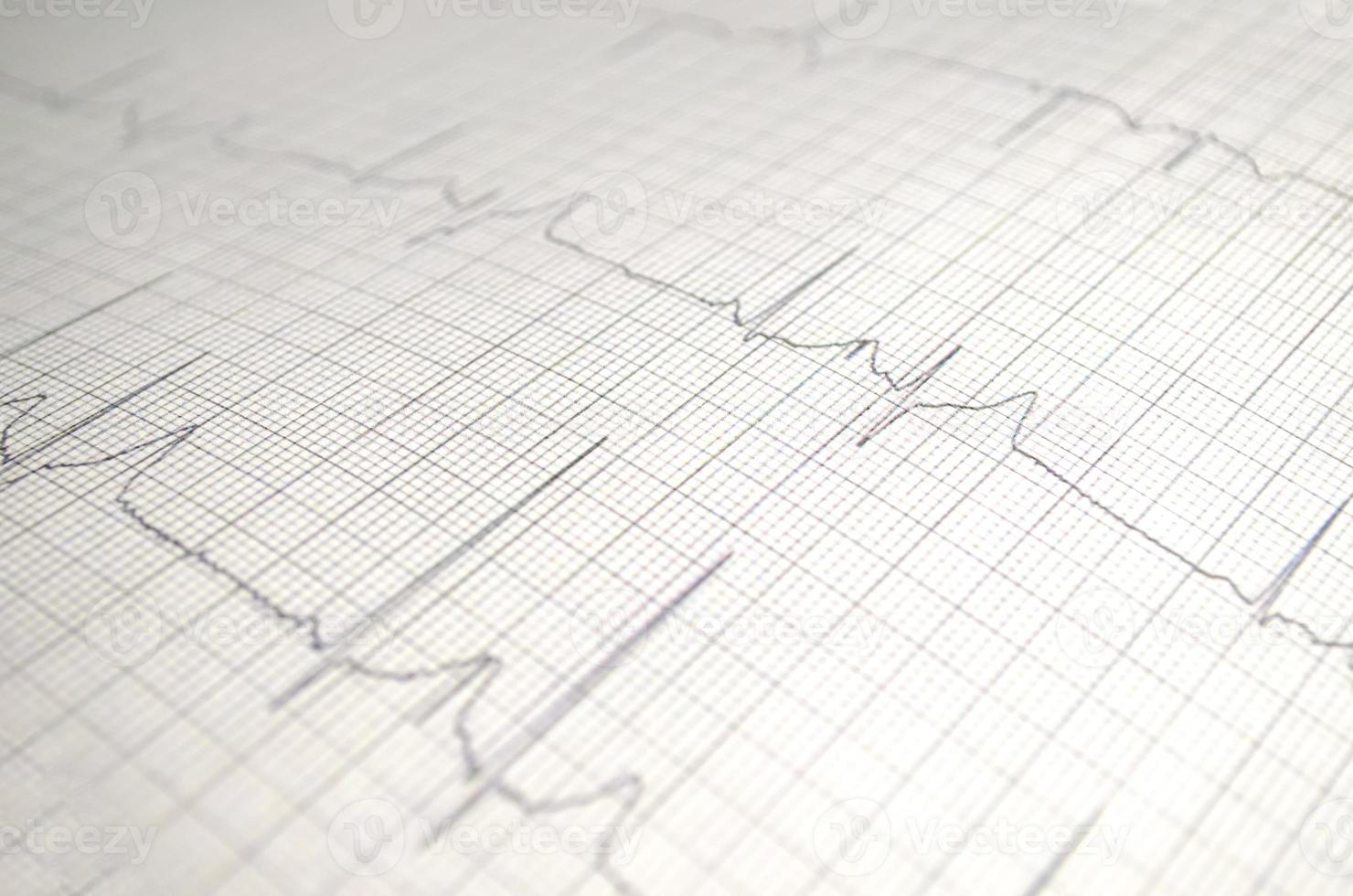 gráfico de cardiograma con primer plano de la mesa médica, para el registro cardíaco del cirujano, enfoque selectivo foto