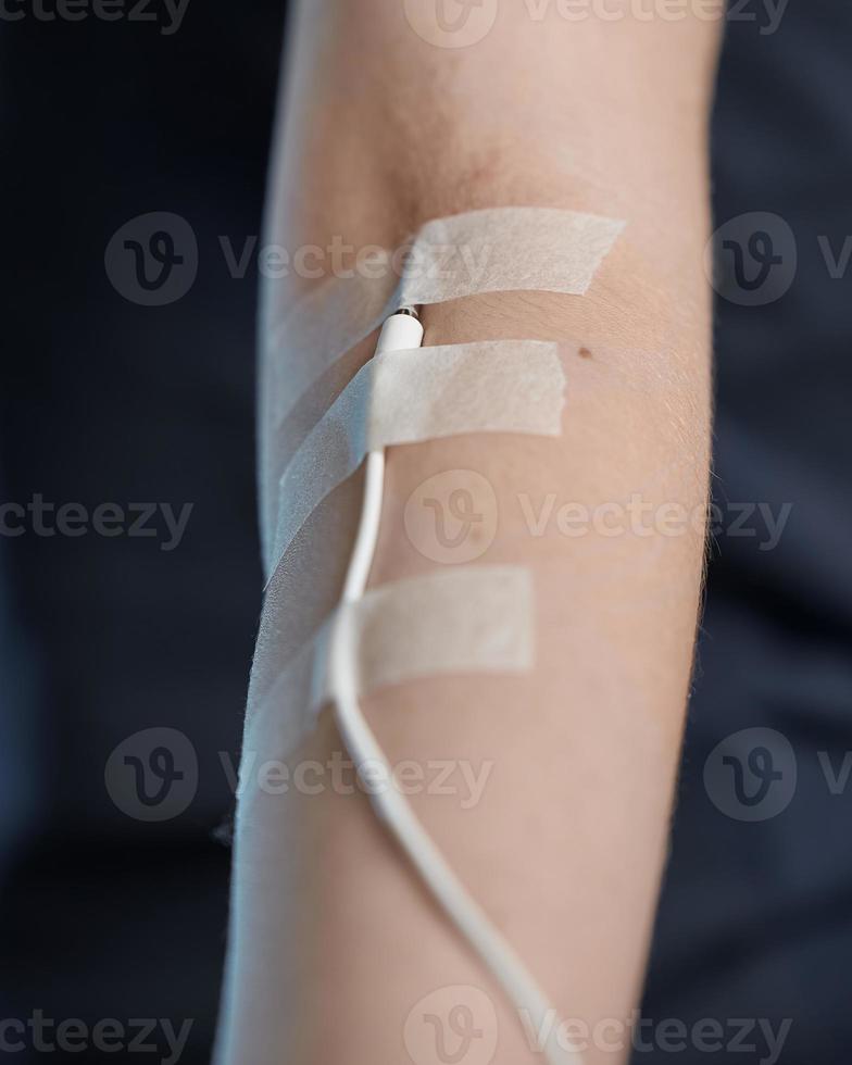Gadget-dependent. The white wire is taped to the arm like an IV. photo
