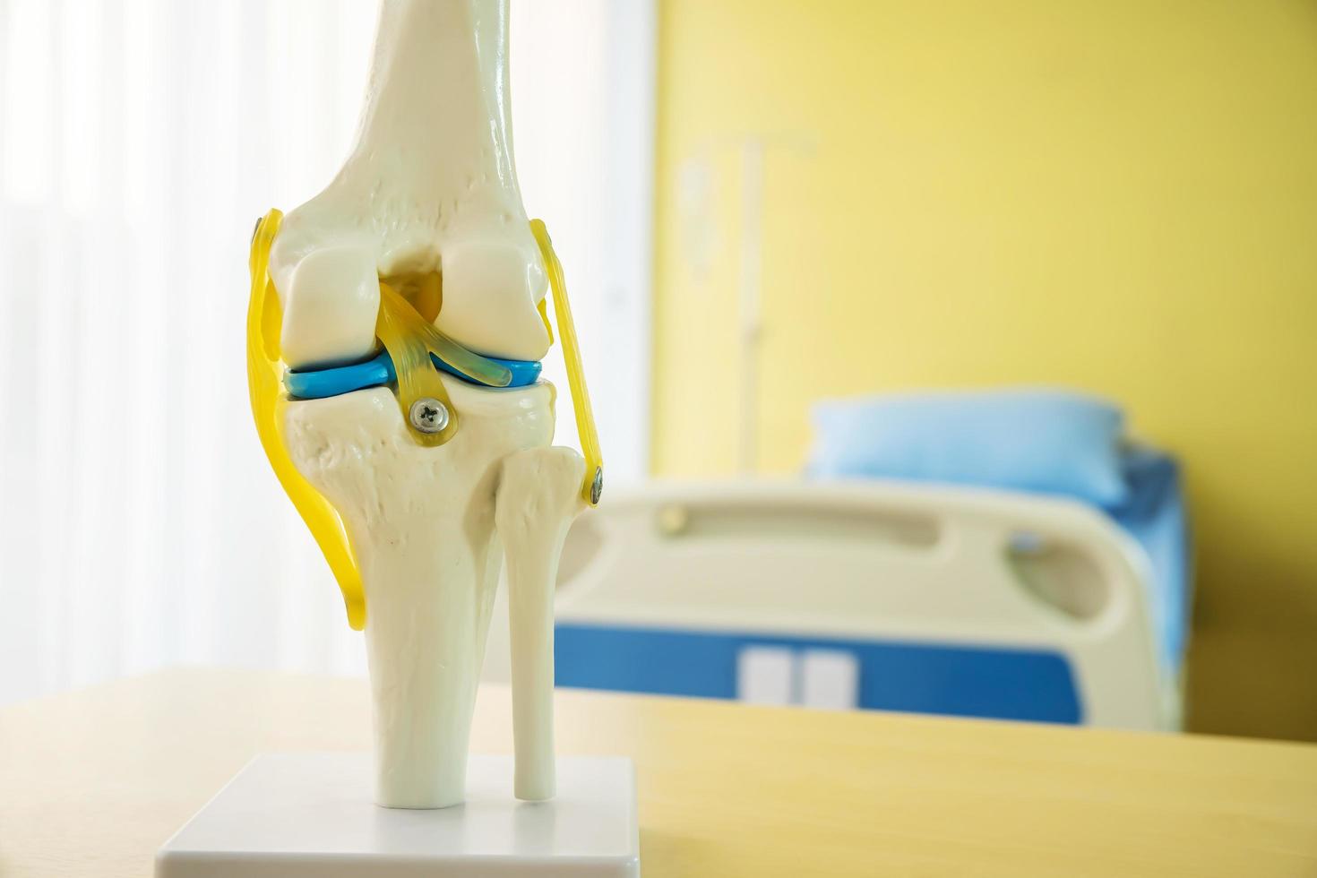 Knee joint anatomy model for medical teaching before they are used to describe the patient as a guideline for surgical decision making on table near patient bed an examination room in a hospital photo