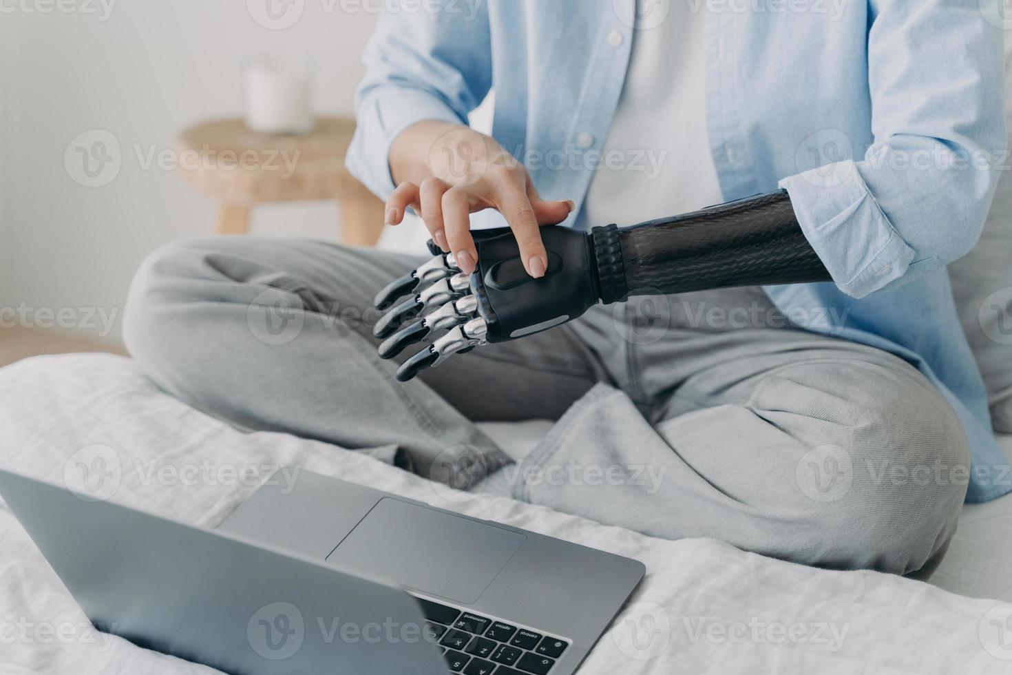 Handicapped woman with artificial arm working on laptop at home. Setting up bionic prosthesis. photo