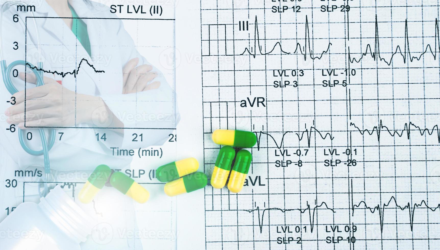 papel de informe gráfico de ekg o ecg. El mejor resultado y las píldoras de cápsulas verde-amarillas con un médico especialista en cardiólogos usan uniforme blanco. médico de pie con los brazos cruzados y estetoscopio de mano. foto