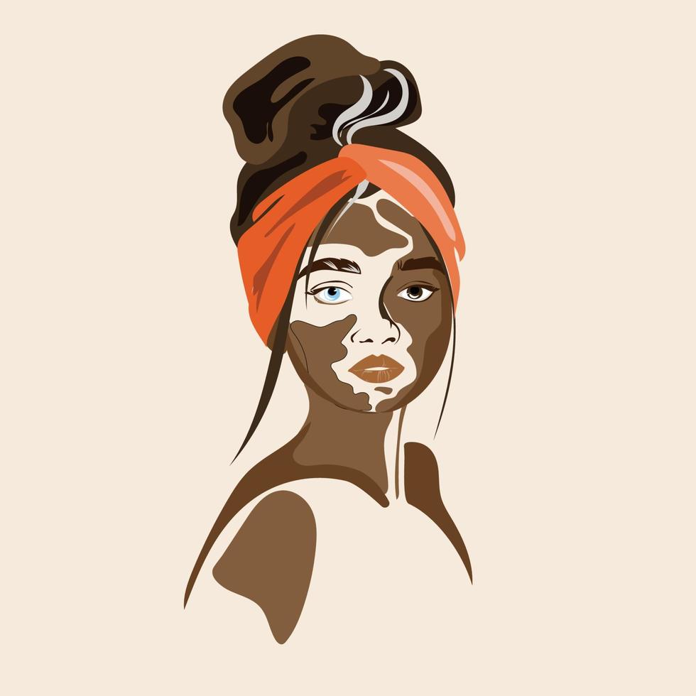 Ilustración de vector de retrato de mujer vitíligo con estilo en estilo moderno. Piel de belleza. Día mundial del vitíligo 25 de junio. Rostro hermoso de una mujer afroamericana. Concepto de tolerancia a la diversidad.