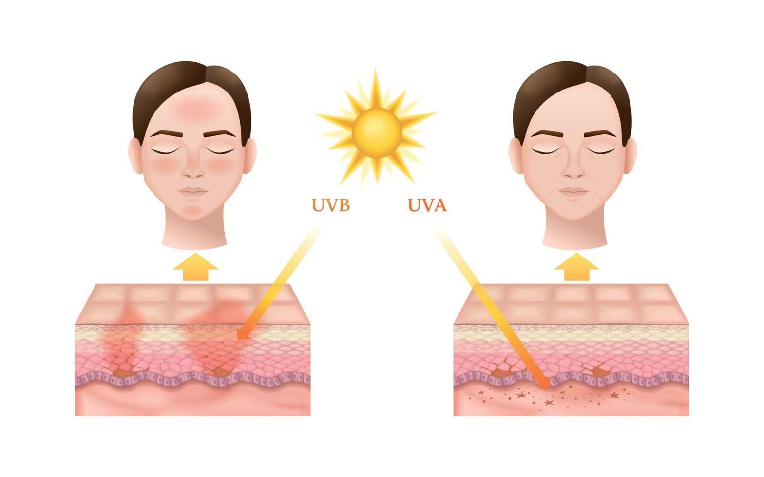 infografía de radiación solar de anatomía de la piel vector