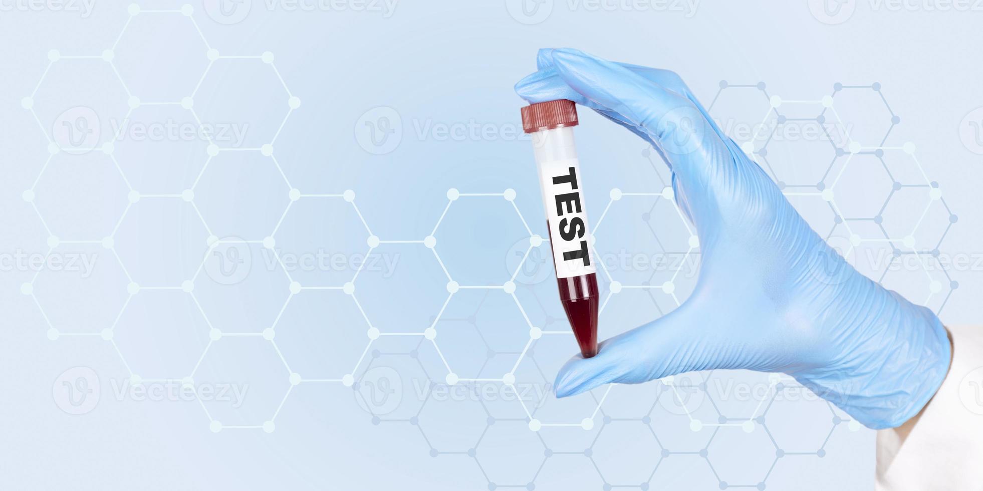 Close-up of a female doctor's hand in medical gloves holding a test tube, vacutainer, with red blood for testing in a hematology laboratory. Copy space. photo
