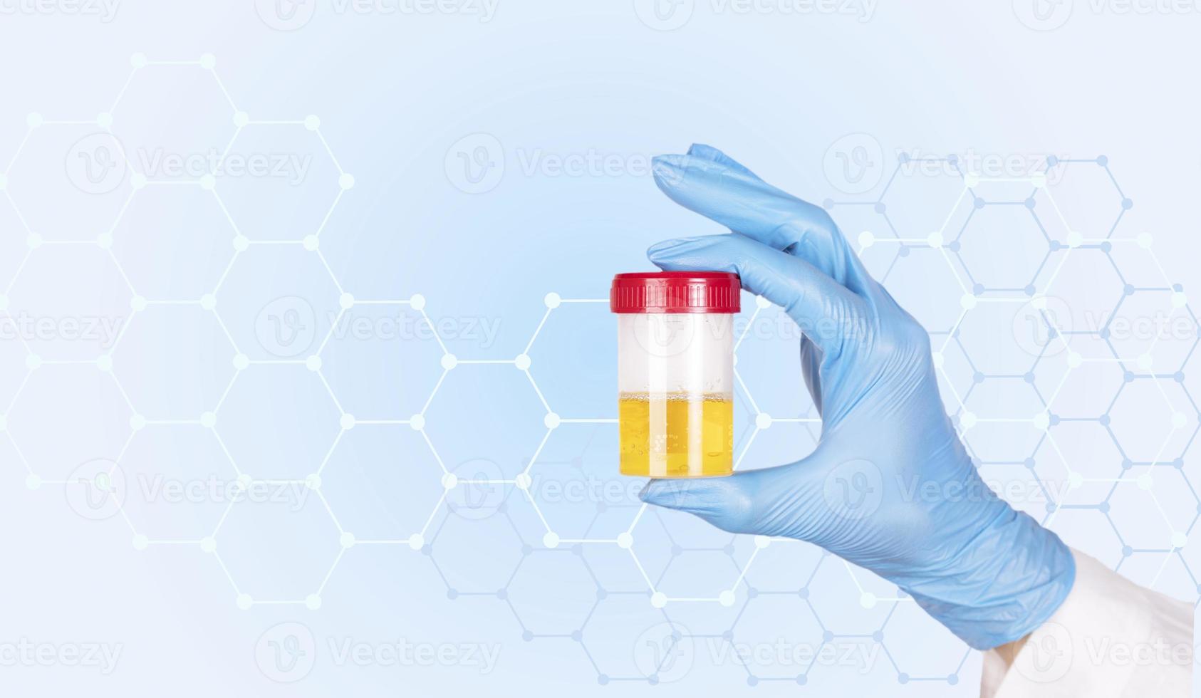 Doctor's hand in a blue glove holding a urine sample, medical urine test in a laboratory on a blue medical background. Copy space photo