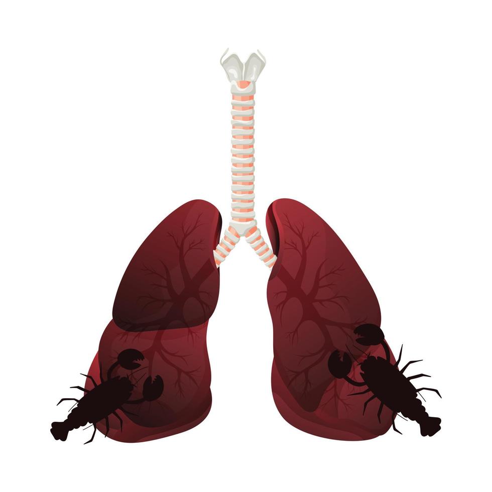 Illustration of lung smoker, lung cancer disease. The concept of stop smoking. Vector illustration.