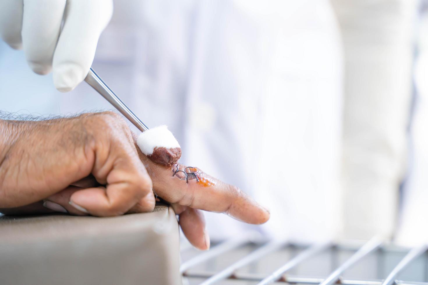 un médico vestido de blanco, con guantes blancos antigérmenes, está limpiando la herida en el dedo de una persona causada por un cuchillo cortado foto