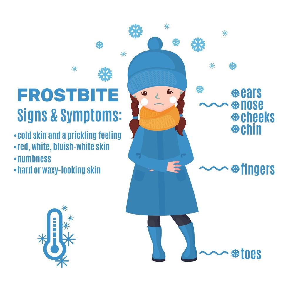 Frostbite infographic in cartoon style isolated on white background. Vector illustration.