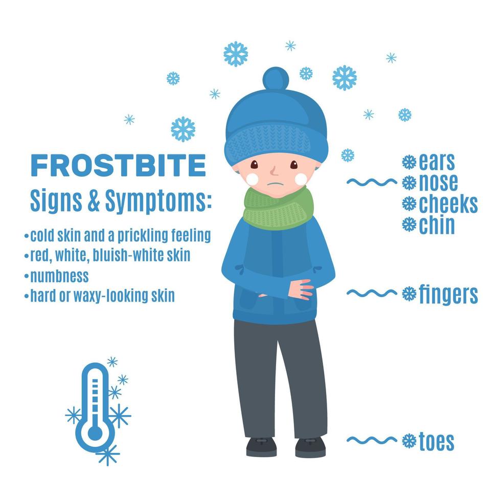 Frostbite infographic in cartoon style isolated on white background. Vector illustration.