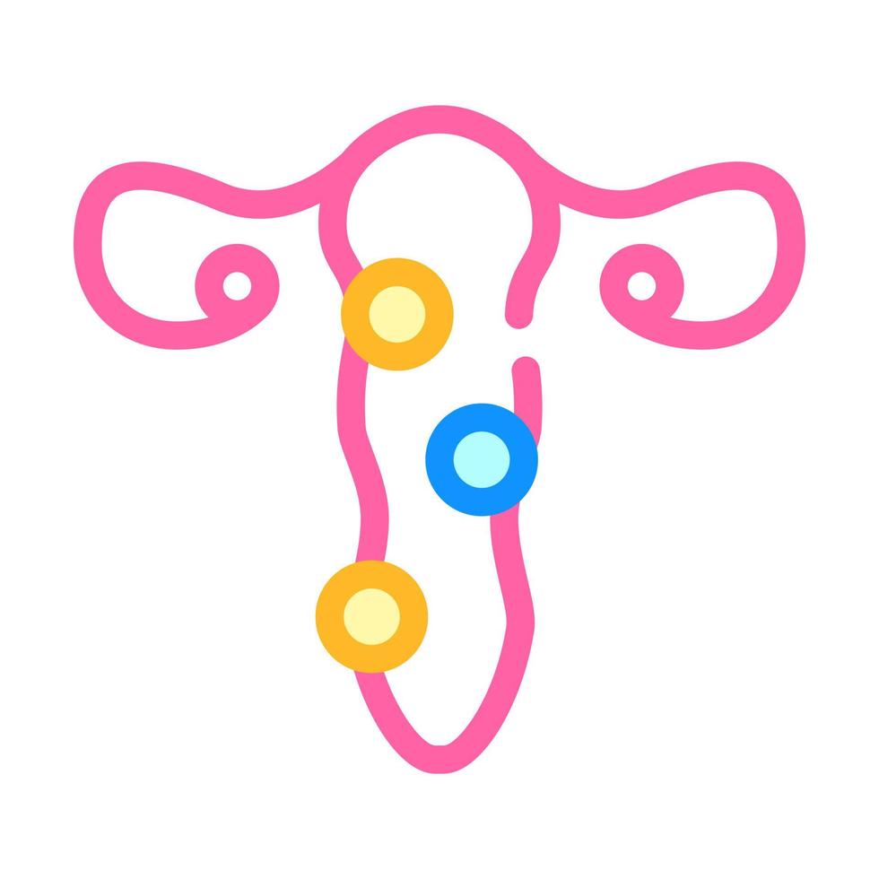 patología de la ilustración de vector de icono de color de cuello uterino