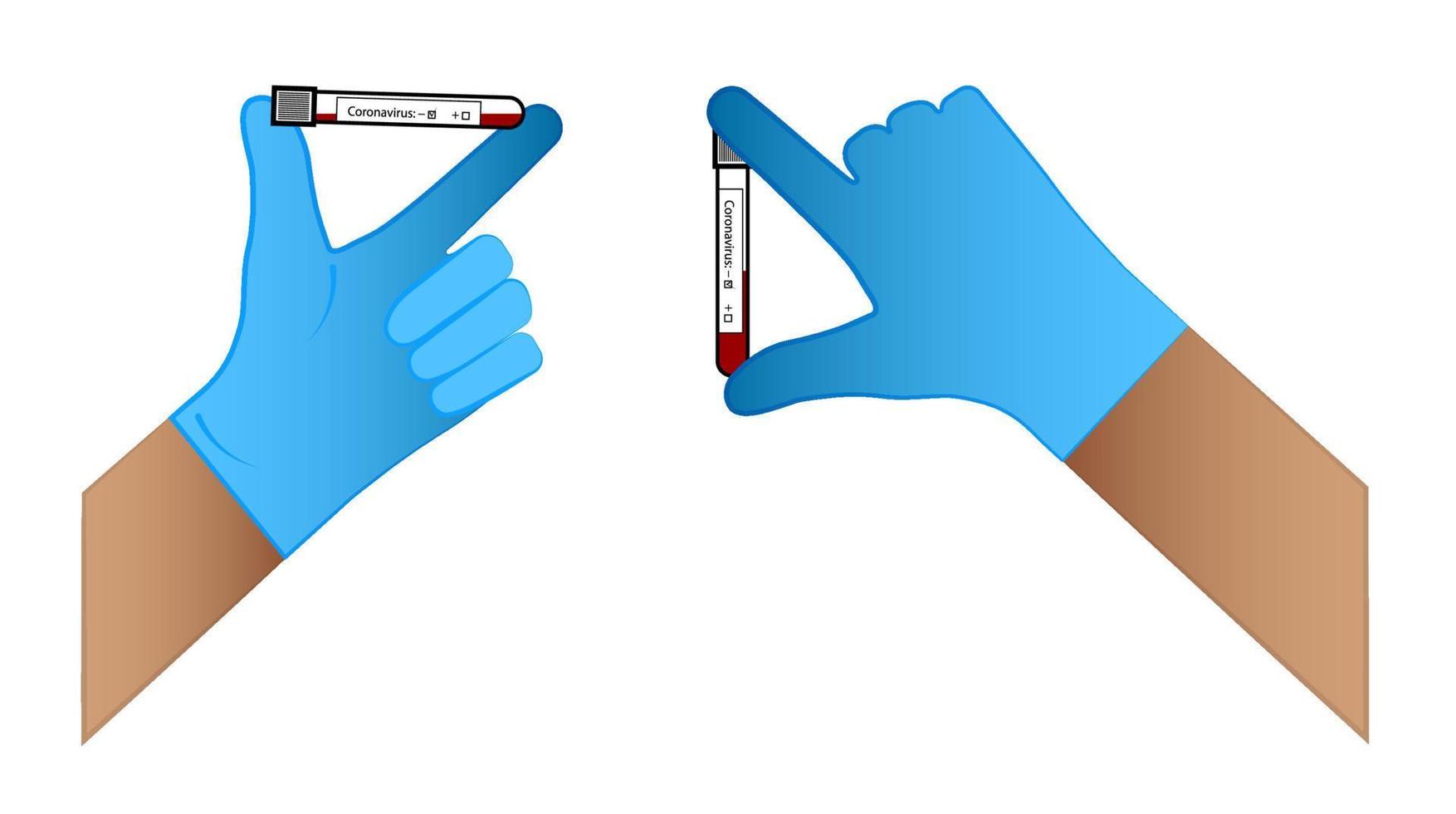 los médicos entregan en un guante tubos de ensayo con pruebas de coronavirus. resultado positivo y negativo. vector aislado sobre fondo blanco