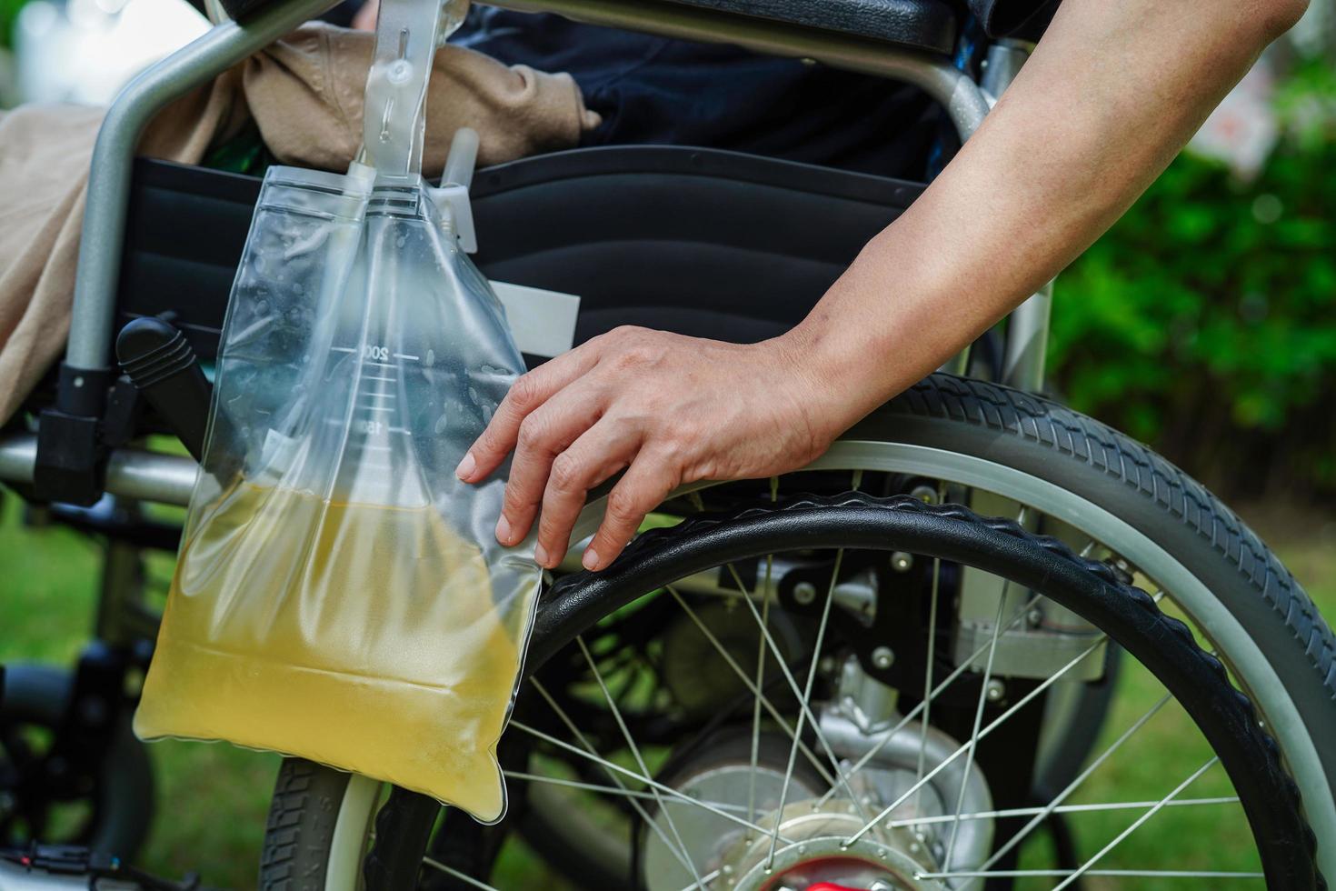 mujer asiática con discapacidad con bolsa de orina en silla de ruedas. foto