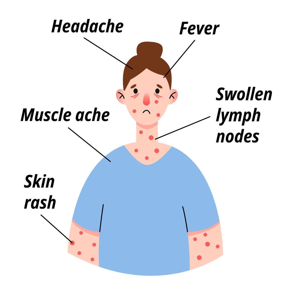 Monkeypox virus symptom infographic on woman patient with fever, headache, swollen lymph node, rashes on face, body and back, muscle aches. Vector flat isolated illustration for print.