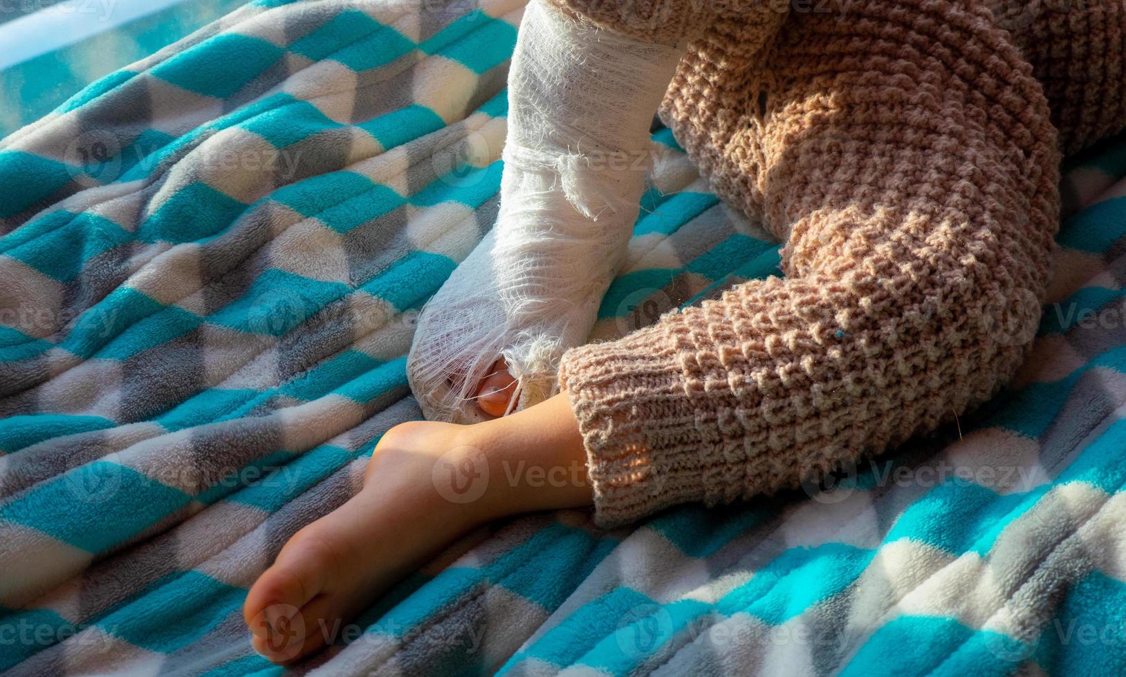 un niño lindo tiene una pierna fracturada rota con un vendaje en