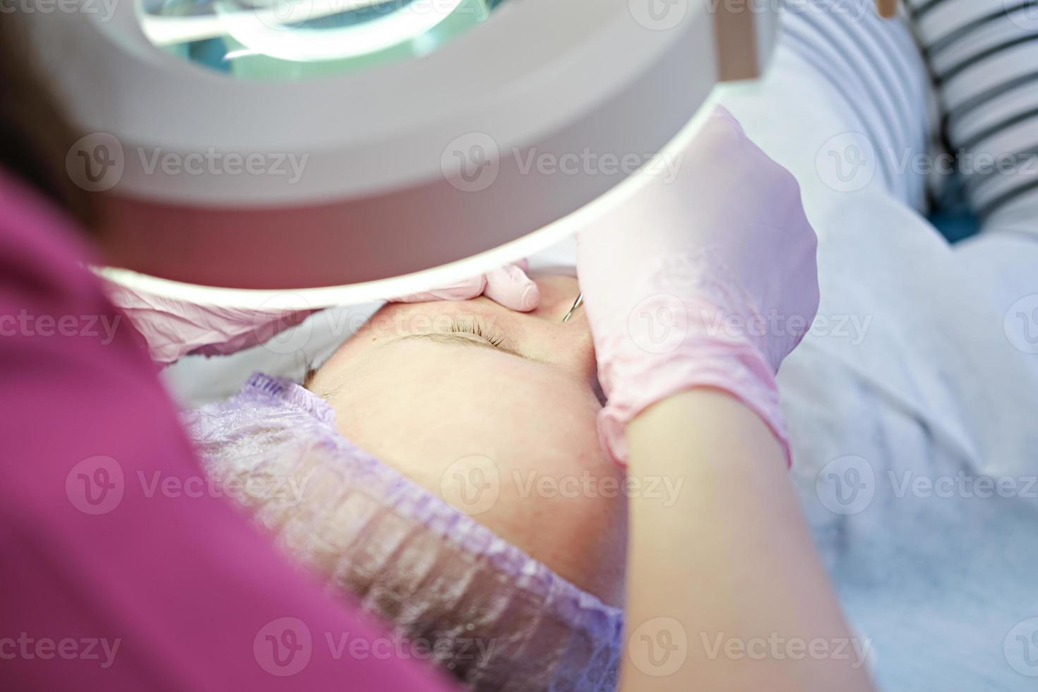 Procedure mechanical face cleaning in beauty salon. photo