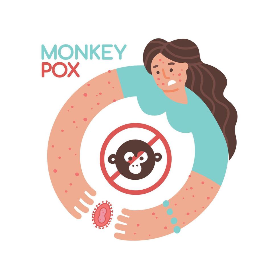 Woman infected with monkeypox. Blisters on the skin when infected. Monkeypox virus Symptoms. Vector illustration of sick female person. Flat human character portrait with red rash on face and arms