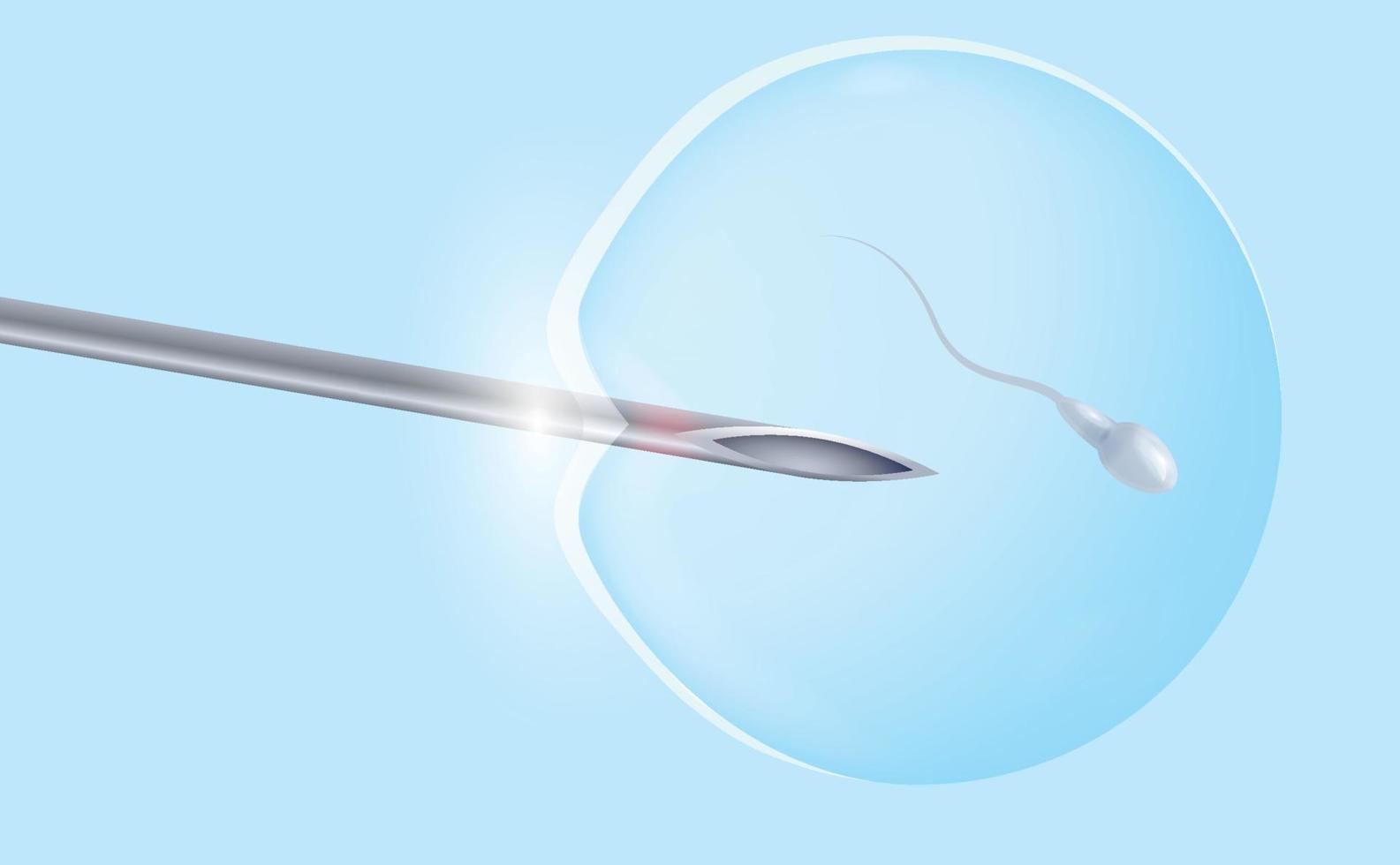 IVF, in vitro fertilization of an egg with a sperm. A medical needle implants the sperm into the egg. Medical poster. Vector illustration