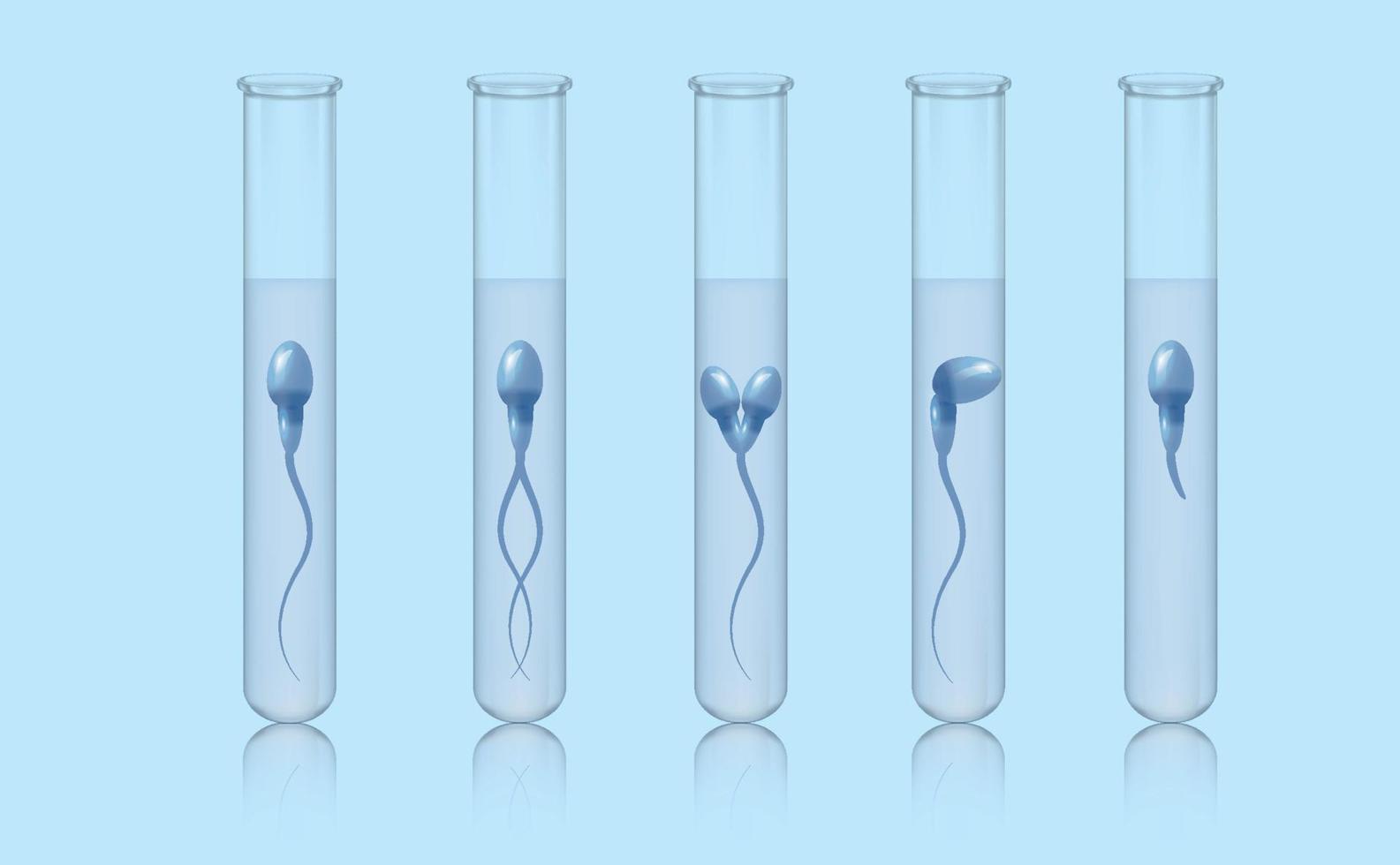 Morphology, spermatozoa in a medical test tube. A set of test tubes with spermatozoa. Sperm motility analysis. Medical poster. Vector illustration