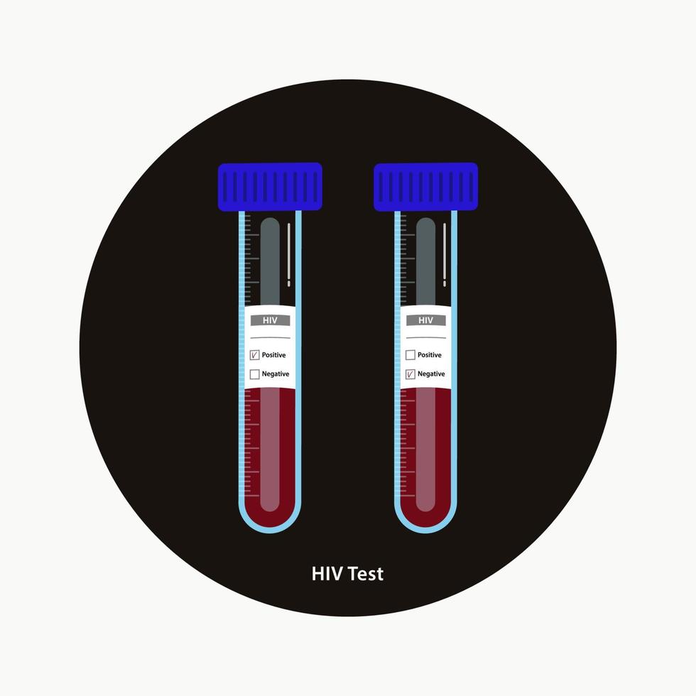HIV blood testing in tubes with positive an negative labels  vector illustration