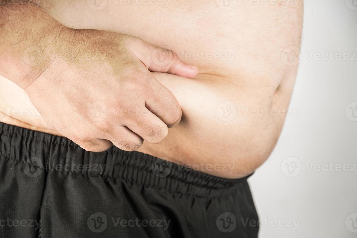 Overweight man body with hands touching belly fat photo