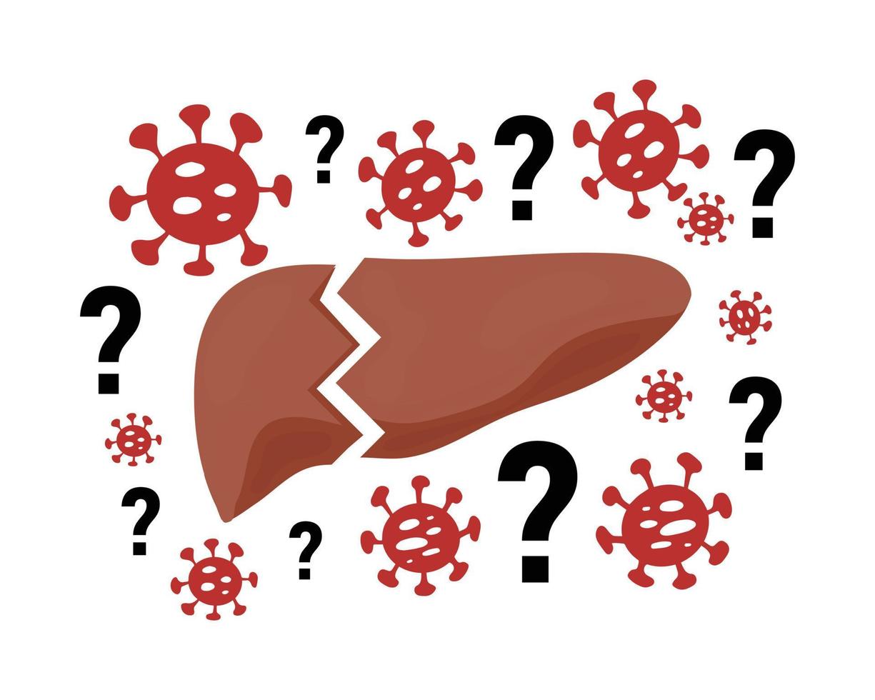 Mysterious Acute Hepatitis of Unknown Cause concept. Vector illustration of damaged liver with bacteria icons and question marks isolated on white background. Liver disease, viral hepatitis outbreak.