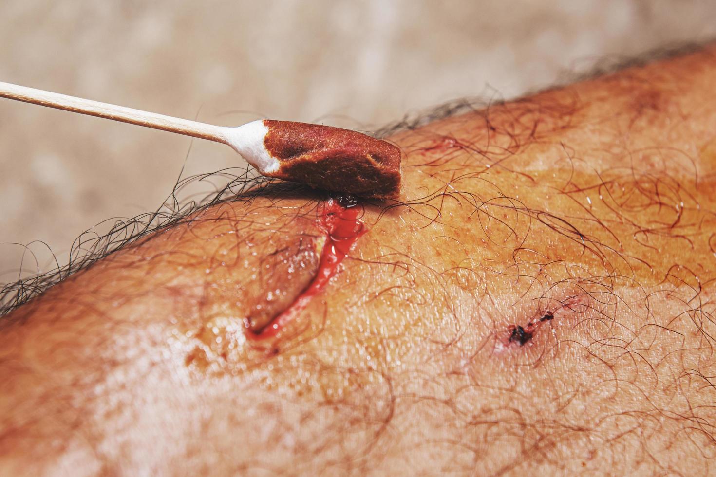 man injured. Close-up wound on  leg.health care concept photo