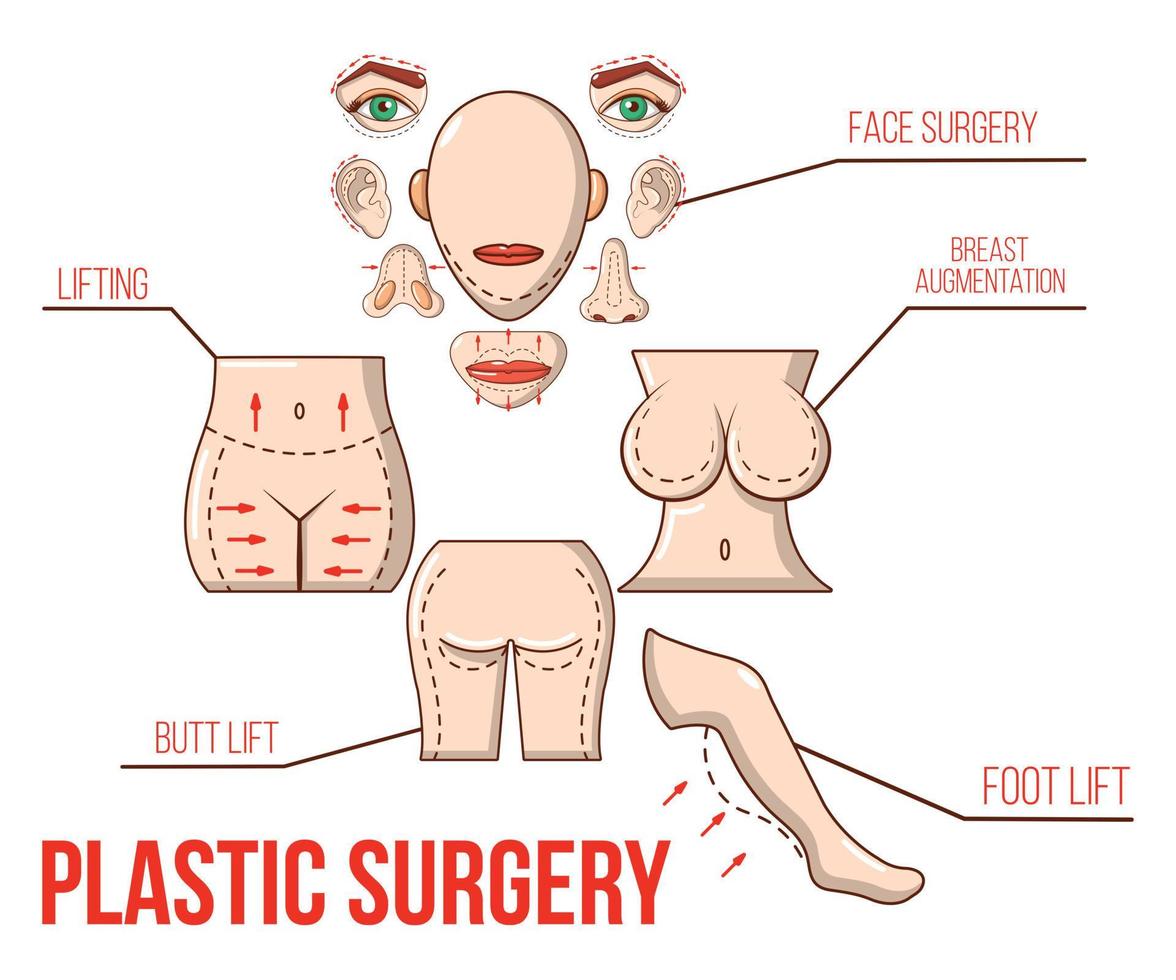 Plastic surgery concept banner, cartoon style vector