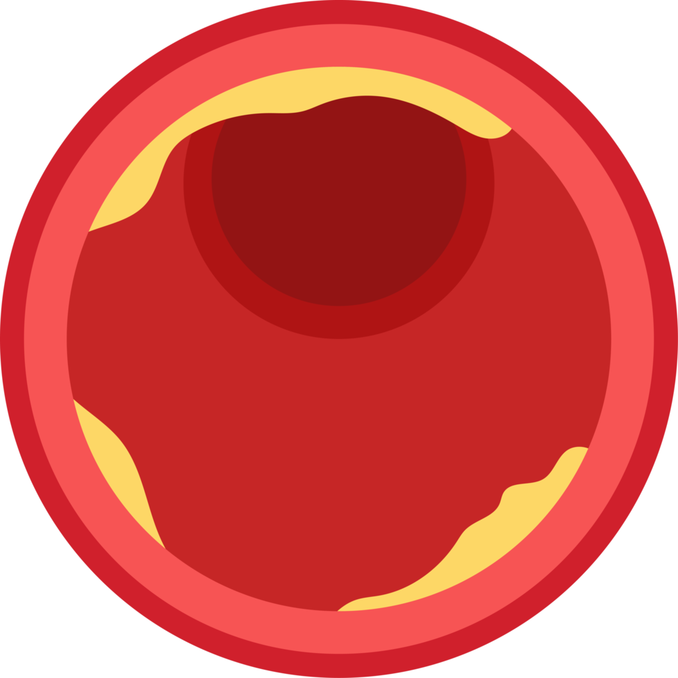 Arteriosclerosis clipart illustration png
