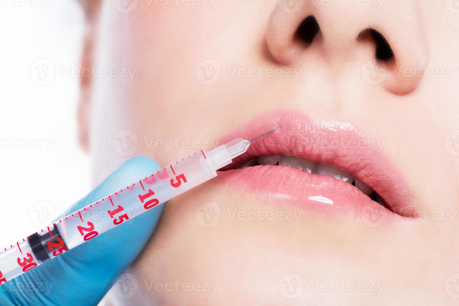 Young woman having botox face injections. photo