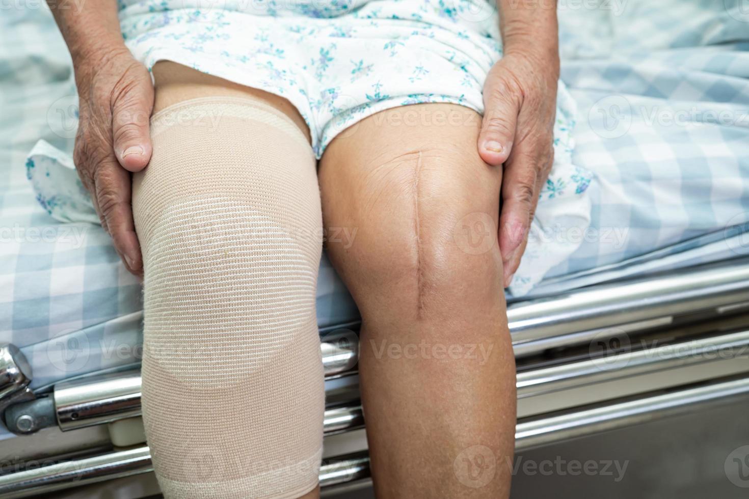 Asian senior or elderly old lady woman patient with knee support pain joint on bed in nursing hospital ward, healthy strong medical concept. photo