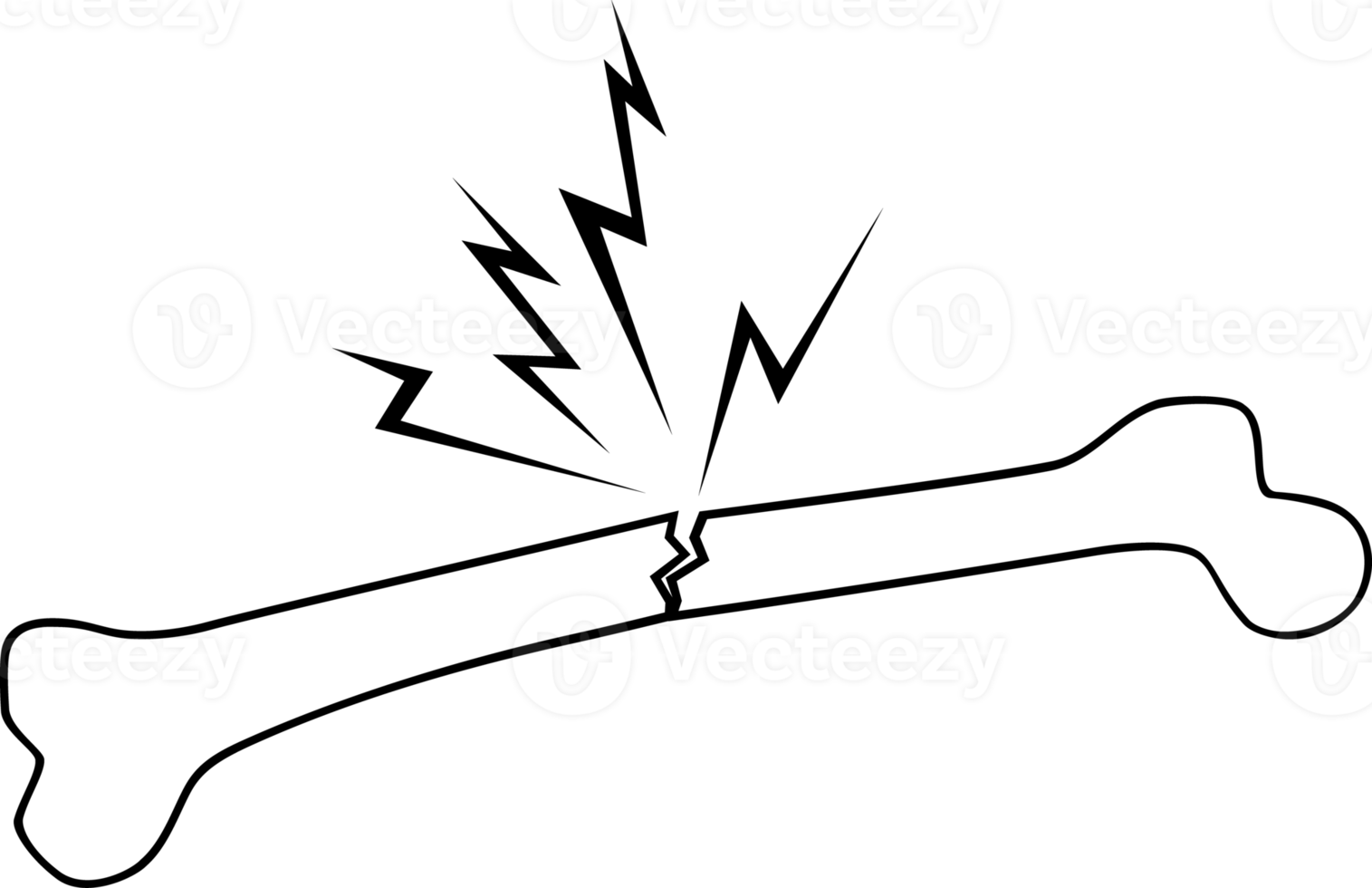 osso humano quebrado png ilustração 8514042 PNG