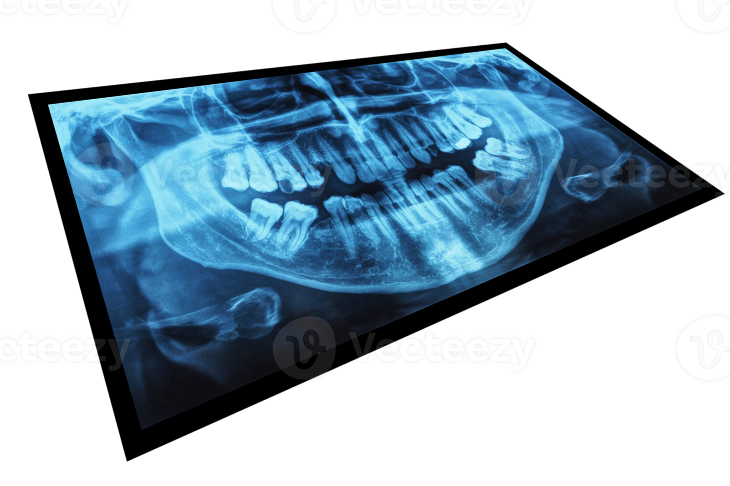 dents xray png transparent