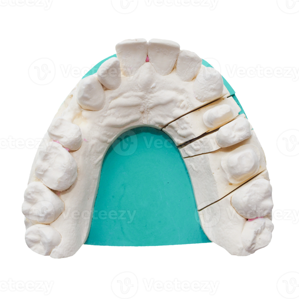 Positive teeth cast transparent PNG