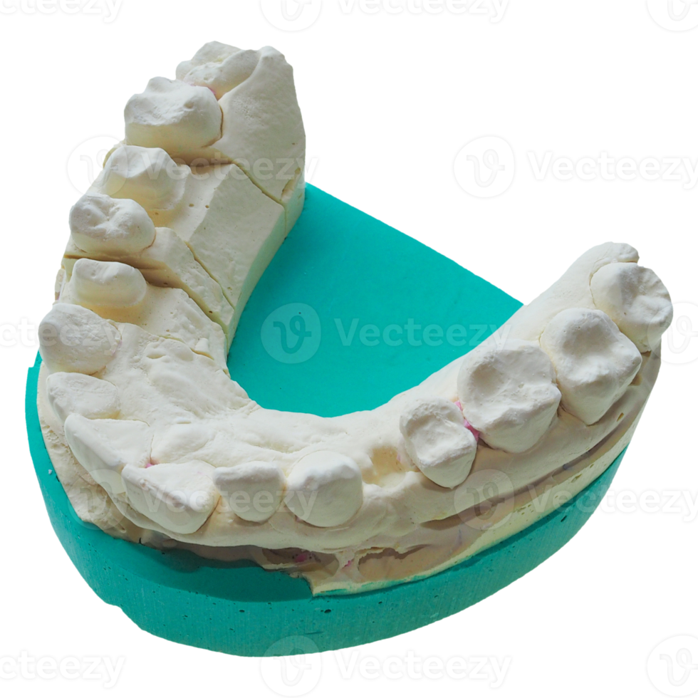 Positive teeth cast transparent PNG