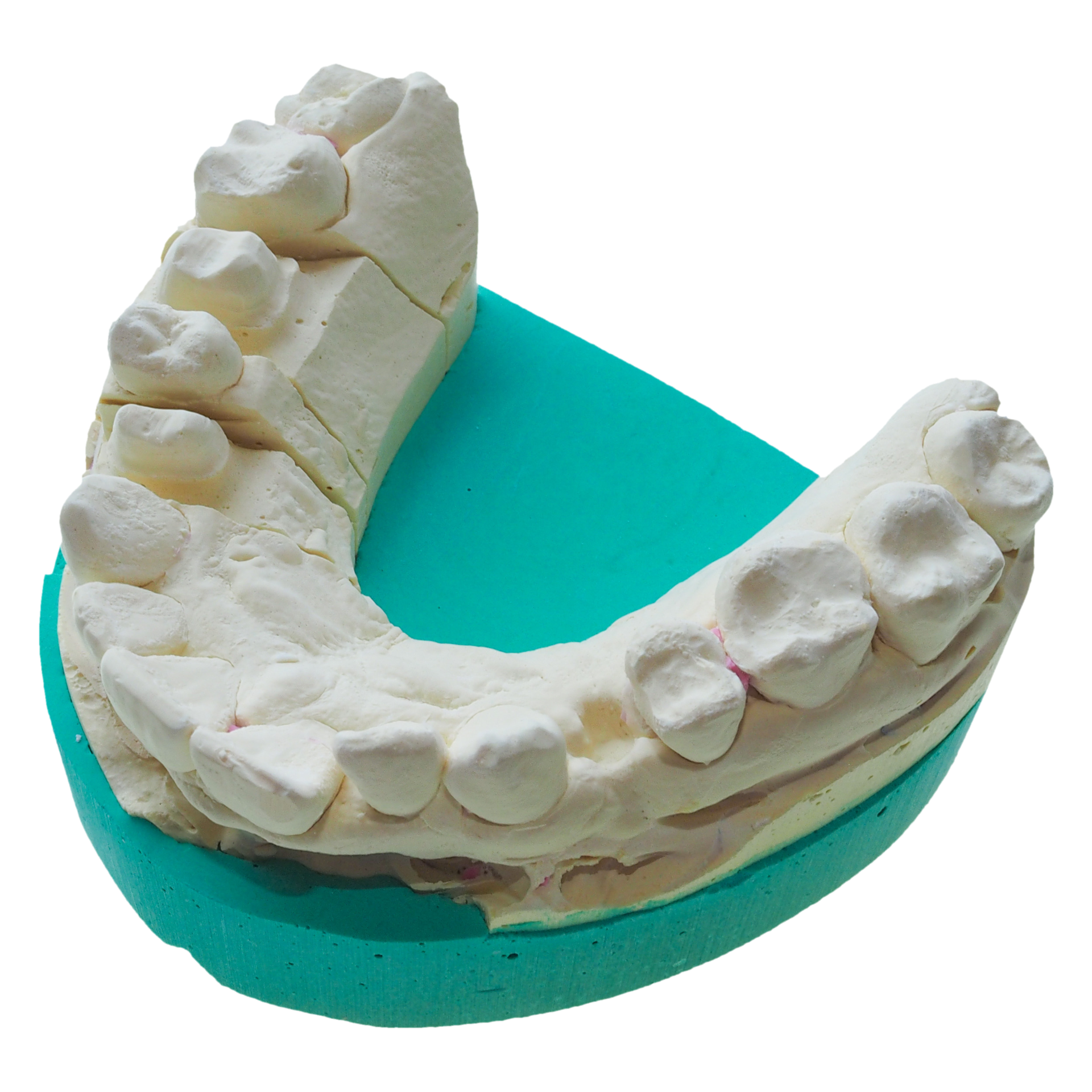 Dental Mold PNG Images & PSDs for Download
